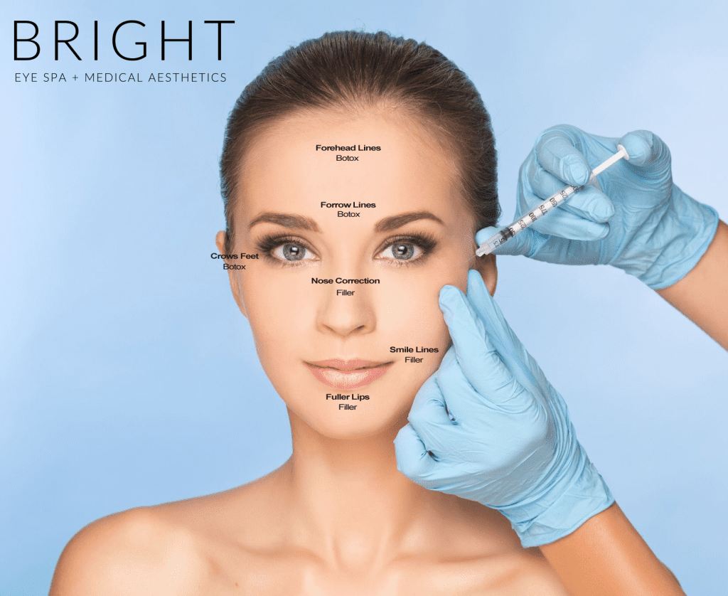 How to Choose Between Botox and Fillers